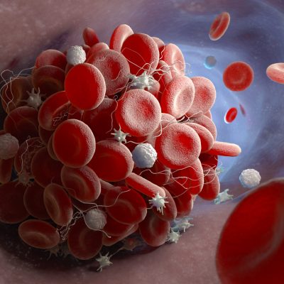 Image of Homeostasis Bro Hemostasis